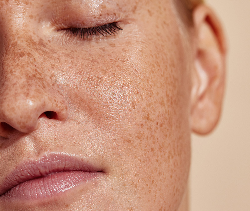 dermaplaning near me eastbourne sussex dermaplaning near me eastbourne sussex