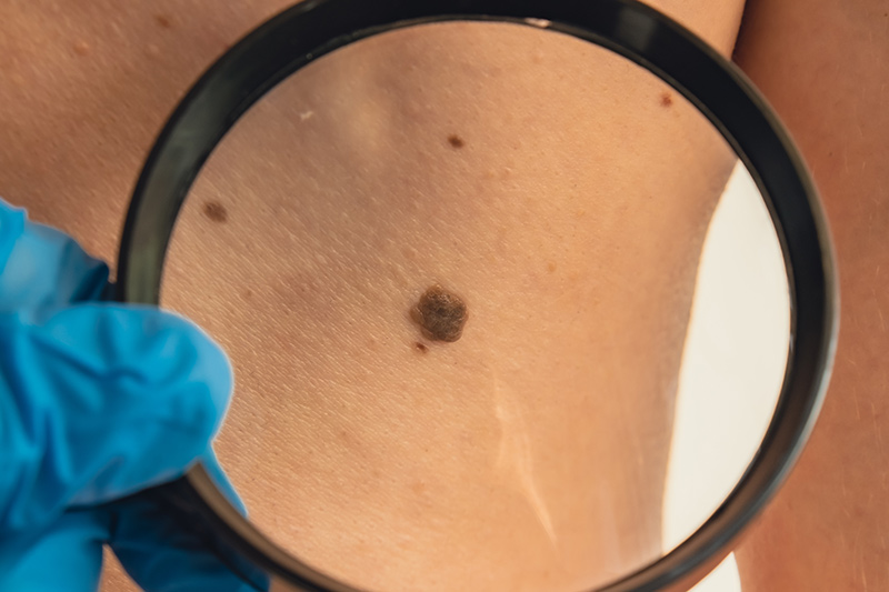 eastbourne mole checking services